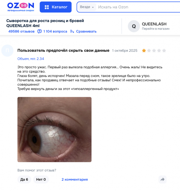 Queenlash отзывы: стоит ли рисковать зрением ради густых ресниц?